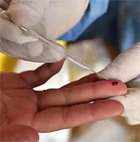 AI phát hiện 3 bệnh ung thư nguy hiểm chỉ với một giọt máu khô