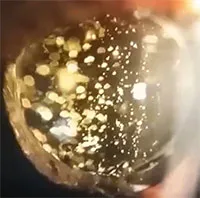 Kỳ lạ những người có mắt "lấp lánh như sao"