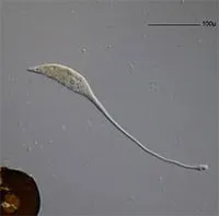 Vi khuẩn giống quái vật hồ Loch Ness có cách bắt mồi độc lạ