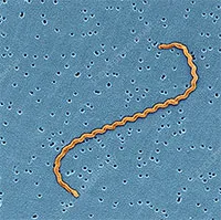 Nhiễm xoắn khuẩn vàng da Leptospira: Nguyên nhân, triệu chứng và cách điều trị