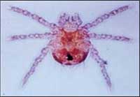 Bệnh sốt mò là gì?