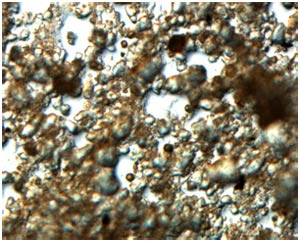 Giải mã bí ẩn của vi khuẩn sống nửa triệu năm