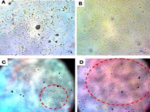 Máu ở phụ nữ: Nguồn tế bào gốc mới