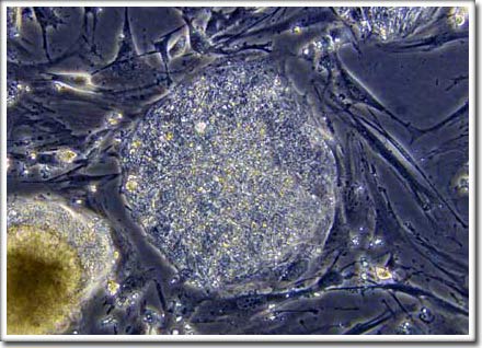 Thêm một bước tiến về tế bào gốc