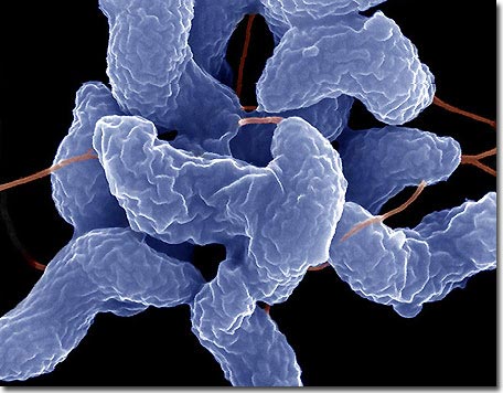 Vi khuẩn đoàn tụ sau hàng triệu năm xa cách