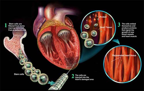 TÌM HIỂU VỀ TẾ BÀO GỐC (Phần 5)