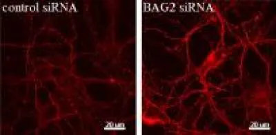 Tiến triển trong việc nghiên cứu bệnh Alzheimer