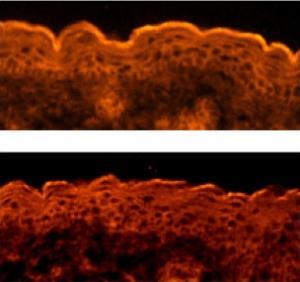 Phát hiện gen điều khiển sự hình thành da