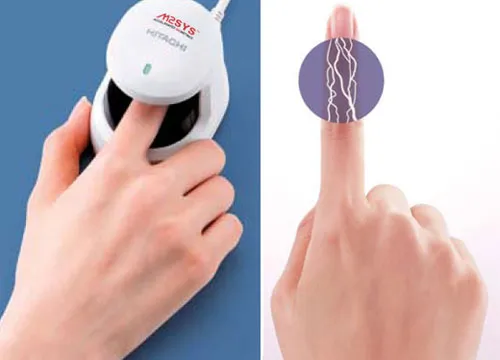 "Cấy" thẻ tín dụng vào đầu ngón tay