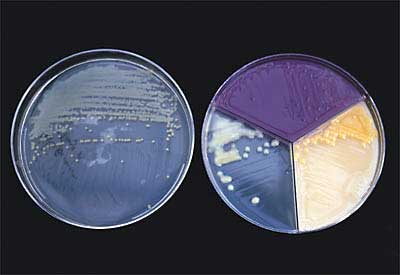 Tạo môi trường tinh khiết để nuôi tế bào gốc