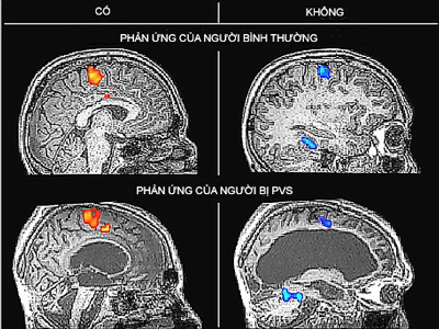 Bệnh nhân sống thực vật có thể “nói chuyện”