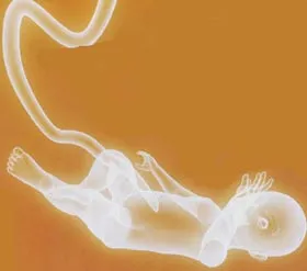 "Lập ngân hàng tế bào gốc từ dây rốn là trò bịp"