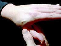 Cấy chip dưới da thay cho mật khẩu