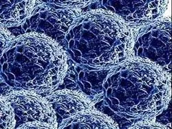 Sử dụng công nghệ nano và ánh sáng điều trị ung thư