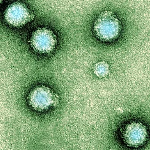 Hai kháng thể vô hiệu hóa virus gây cứng khớp