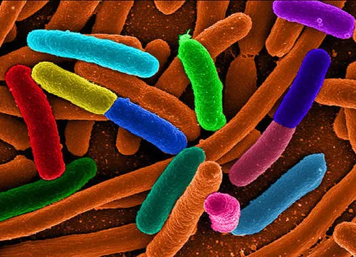 Khuẩn E.coli gây tử vong ở châu Âu là chủng mới, cực độc