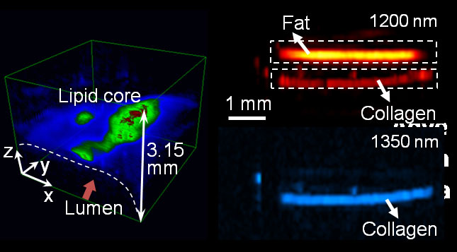 Thiết bị Photoacoustic giúp phát hiện sớm ung thư da