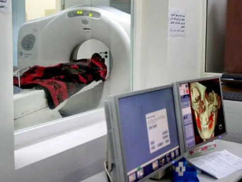 Chụp CT, trẻ có nguy cơ ung thư não cao