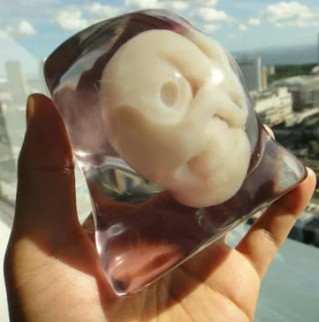Mô hình 3D của bào thai