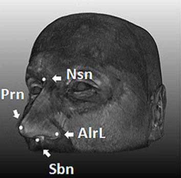 Xác định 5 gene quy định hình dạng khuôn mặt