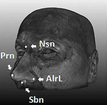 Xác định 5 gene quy định hình dạng khuôn mặt