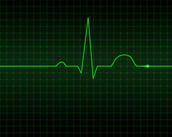 Phương pháp mới điều trị chứng rối loạn nhịp tim