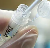 Phát hiện ưu thế của xét nghiệm ADN từ nước bọt