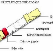 Sản xuất que chẩn đoán nhanh bệnh ký sinh trùng