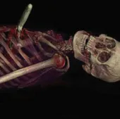 Mổ xác "ảo"