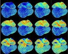 Chuột thí nghiệm có tim phát sáng