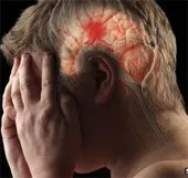 Giải mã "lá chắn đột quỵ" của não