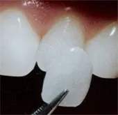 Nuôi răng thật từ tế bào