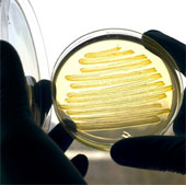 Vi khuẩn E.coli có thể sản xuất diezel