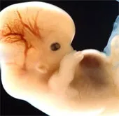 Lần đầu tiên nhân bản phôi người