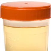 Dễ dàng cô lập được tế bào gốc trong nước tiểu