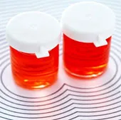 Brazil thử vắc xin phòng chống virus HIV trên khỉ