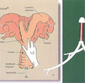 Đặt vòng cho bò để tăng năng suất sản xuất thịt