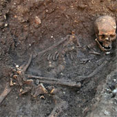 Chẩn bệnh cho vua Richard III