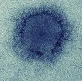 Virus gây bệnh MERS từng lây từ động vật sang người