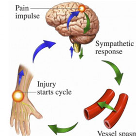 Hội chứng bí ẩn gây đau đớn hơn đau đẻ