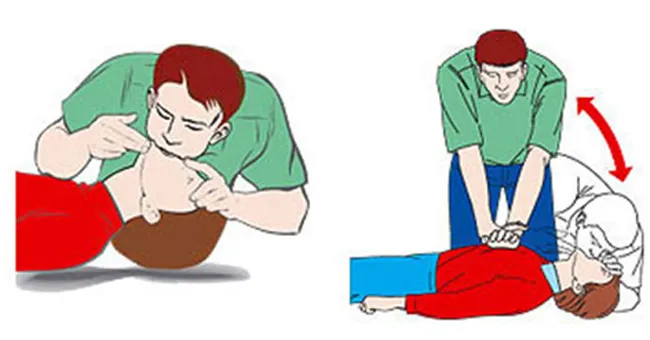 Kỹ thuật sơ cấp cứu