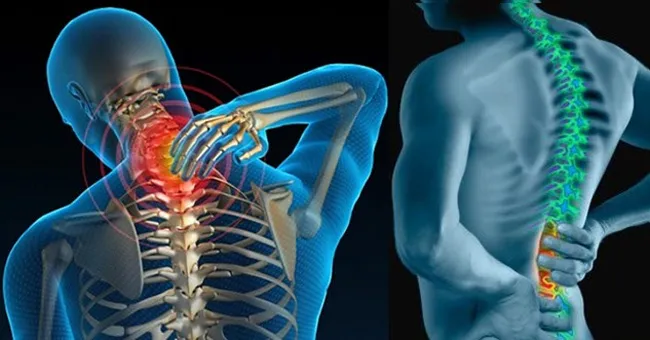 Đau mỏi vai gáy và đau lưng