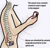 Thiết bị giúp phụ nữ "lên đỉnh" bằng nút bấm