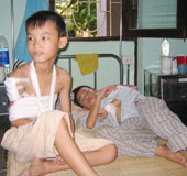 Bộ Y tế đưa ra hướng giải quyết bệnh xơ hóa cơ Delta tại Hà Tây