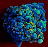 Bé gái 4 tuổi "được chữa khỏi HIV" lại tái nhiễm