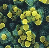 Virus nhiễm "10 người, chết 9" dễ lây lan trên máy bay?
