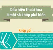 Dấu hiệu nhận biết sớm triệu chứng thoái hóa khớp