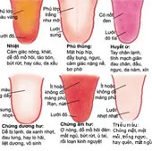 Đoán sức khỏe qua lưỡi của bạn