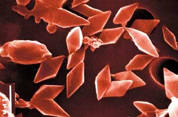 Dũng sĩ trừ sâu - Khuẩn Thuring (Bacillus thuringiensis)