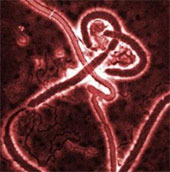 Mỹ thừa nhận Ebola có thể lây lan trong không khí